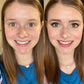⏳Beperkte tijd 50% korting💥Tri-Coloured Concealer Palette Om Acne Littekens En Donkere Kringen Te Bedekken